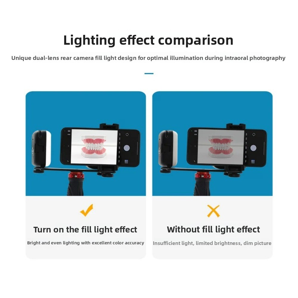 Dental Photography Light, Blue - Photography Led Lighting Kit incelemesi ve fiyatı